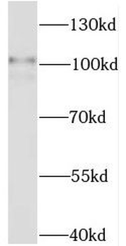 STAT6 Rabbit Polyclonal Antibody