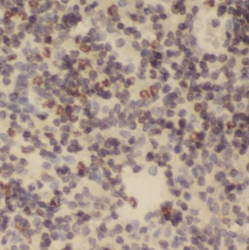STAT6 Rabbit Polyclonal Antibody