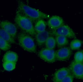 STMN1 Antibody