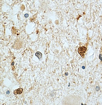 STMN1 Antibody