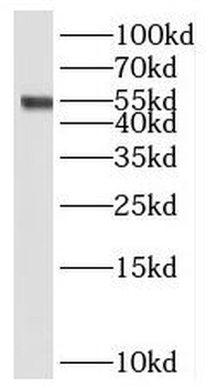 STEAP3 Antibody