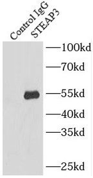 STEAP3 Antibody