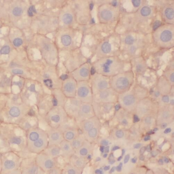 STEAP3 Antibody