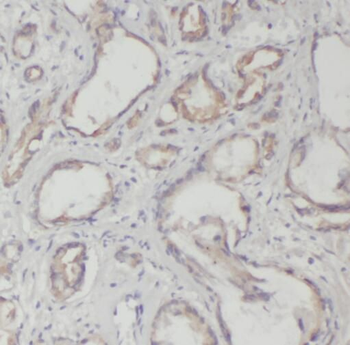 STEAP4 Antibody