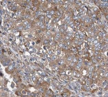 STIM1 Antibody