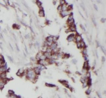 STIM1 Antibody