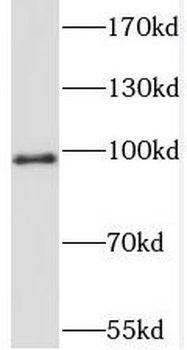 STIM2 Antibody