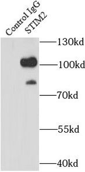 STIM2 Antibody