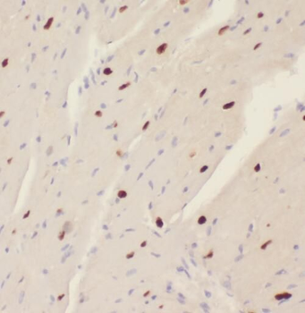 STK17A Antibody