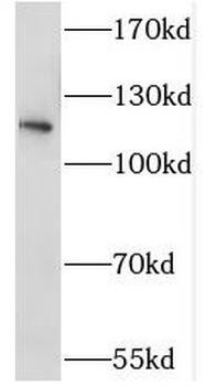 STK31 Antibody