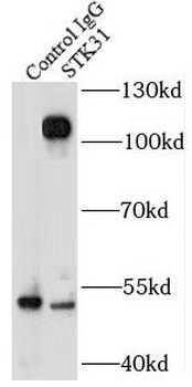 STK31 Antibody