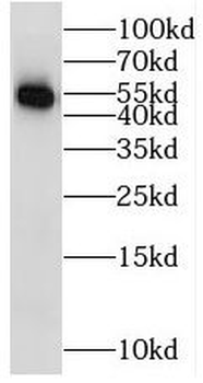 STK33 Antibody