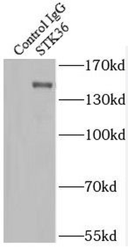 STK36 Antibody