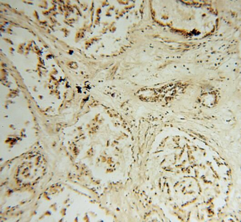 STK36 Antibody
