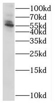 STK38 Antibody