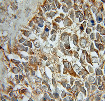 STMN2 Antibody