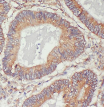 STMN3 Antibody