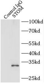 STOM Antibody