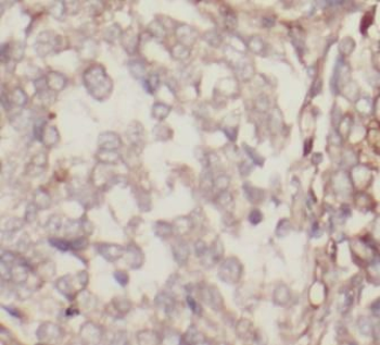 STOM Antibody