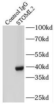STOML2 Antibody
