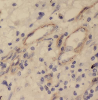 STOML2 Antibody