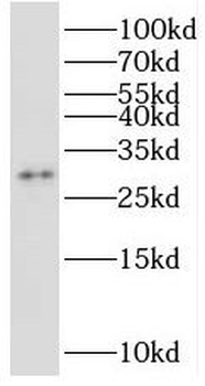 STOML3 Antibody