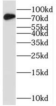 STRBP Antibody