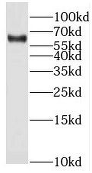 STS Antibody