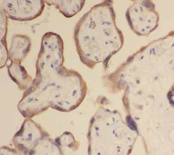 STS Antibody