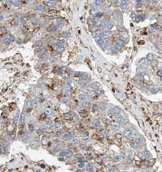STT3A Antibody