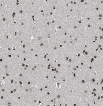 STXBP1 Rabbit Polyclonal Antibody