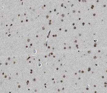 STXBP1 Rabbit Polyclonal Antibody