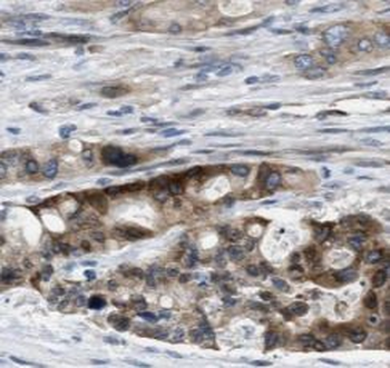 STXBP4 Antibody