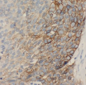 STXBP6 Antibody