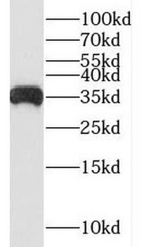 SUCLG1 Antibody