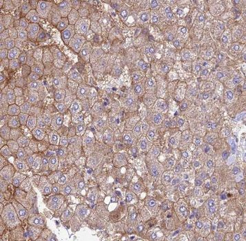 SUCLG1 Antibody