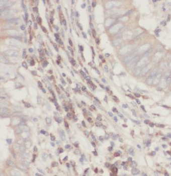 SUCLG2 Antibody