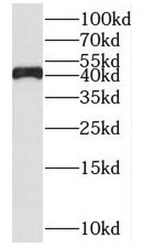 SUDS3 Rabbit Polyclonal Antibody