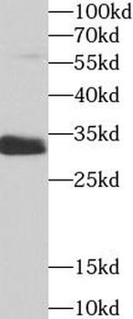 SULT1A1 Antibody