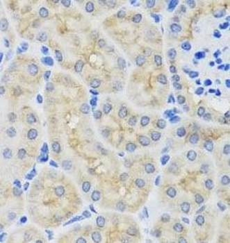 SULT1A1 Antibody