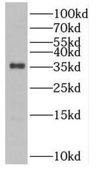 SULT1B1 Antibody