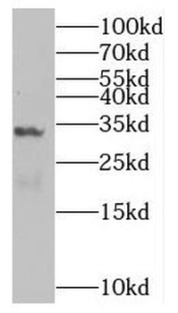 SULT1C2 Rabbit Polyclonal Antibody
