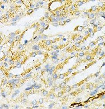 SULT2A1 Antibody