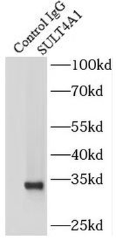 SULT4A1 Antibody