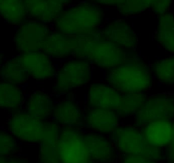 SUMO2/3 Antibody
