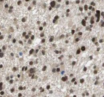 SUMO2/3 Antibody