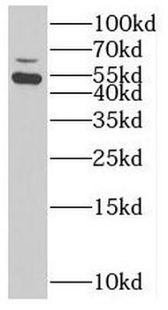 SUOX Antibody