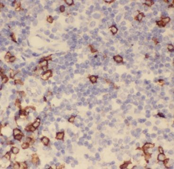 SUPT16H Antibody