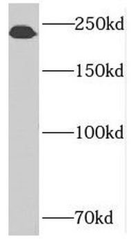 SUPT6H Rabbit Polyclonal Antibody