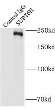 SUPT6H Rabbit Polyclonal Antibody